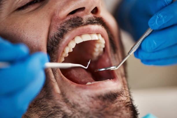 Trusted AR Emergency Dentist Experts