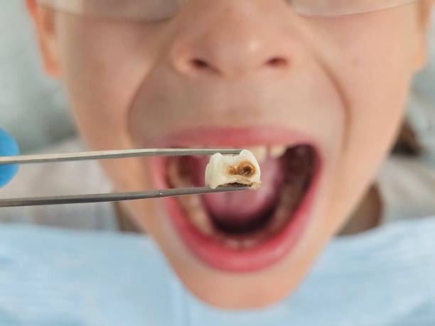 Best Emergency Dental Services for Seniors in Bono, AR